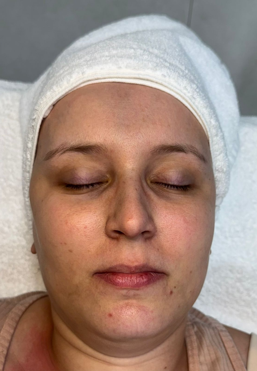 metodo renata frança Miracle Face blumenau