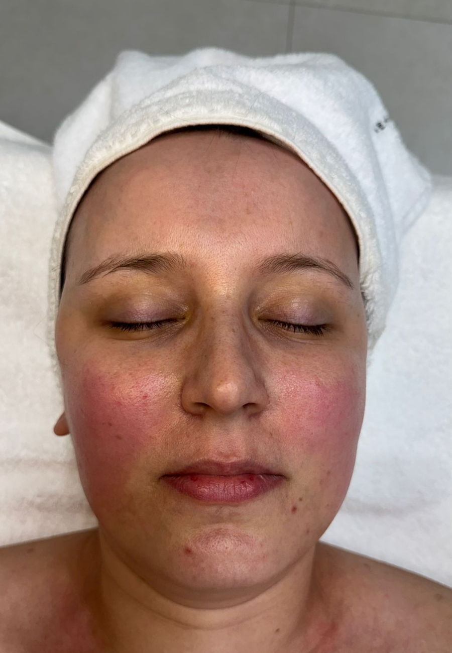 metodo renata frança Miracle Face metodo renata frança Miracle Face blumenau