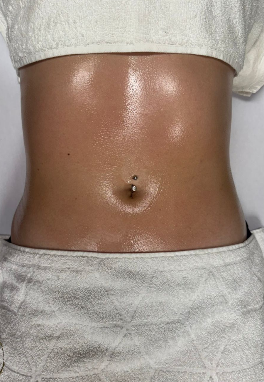 metodo renata frança drenagem blumenau metodo renata frança drenagem blumenau