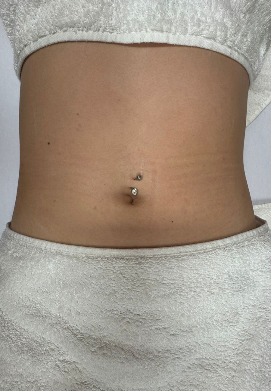 metodo renata frança drenagem blumenau